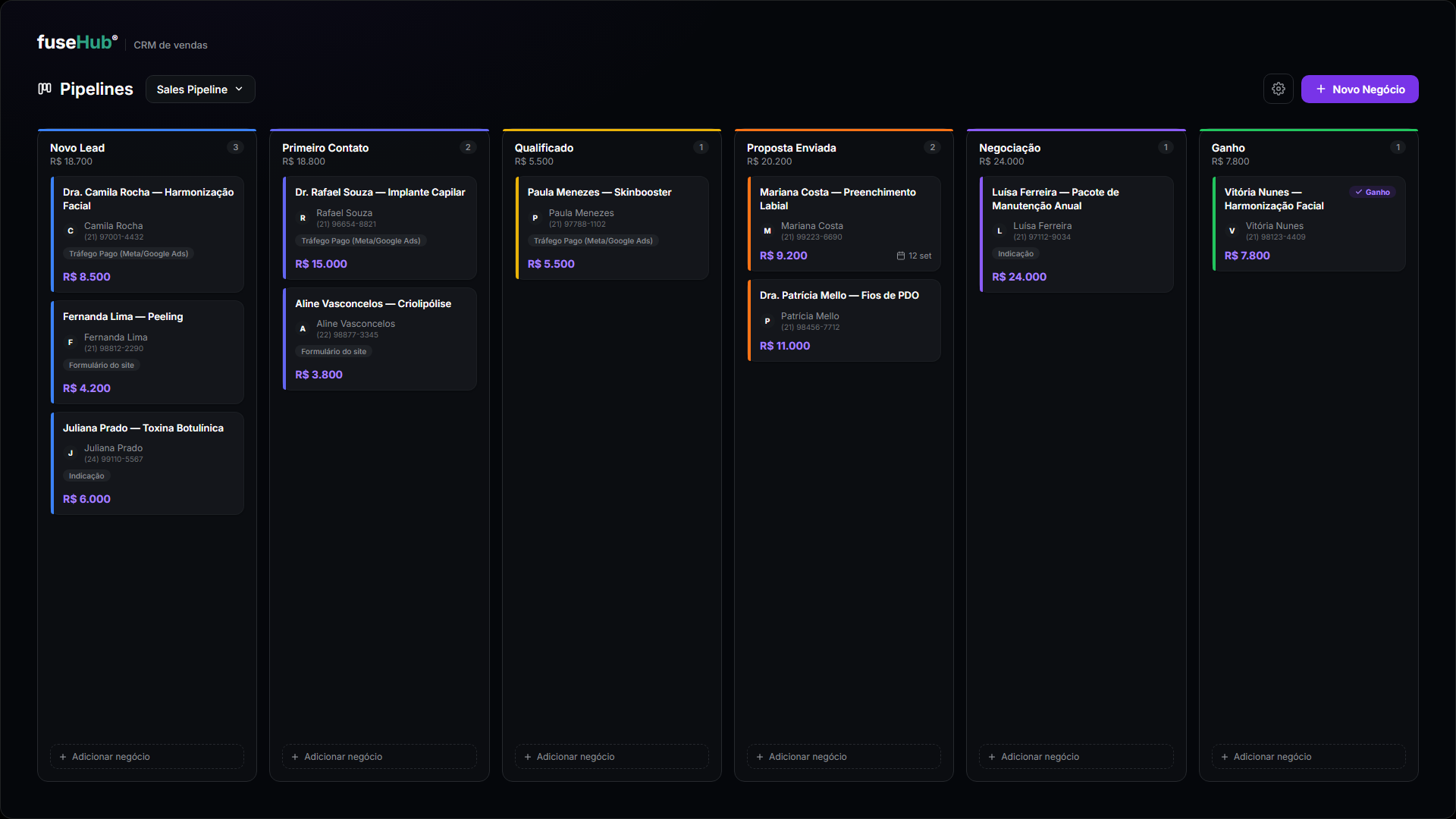 Pipeline visual do FuseHub, CRM da Fuse